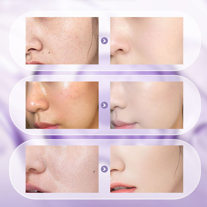 🎉Summer Hot Sale🎉All-in-One Niacinamide Cream